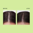 Quench Tea Tree Dandruff Control Ampoule pic 5