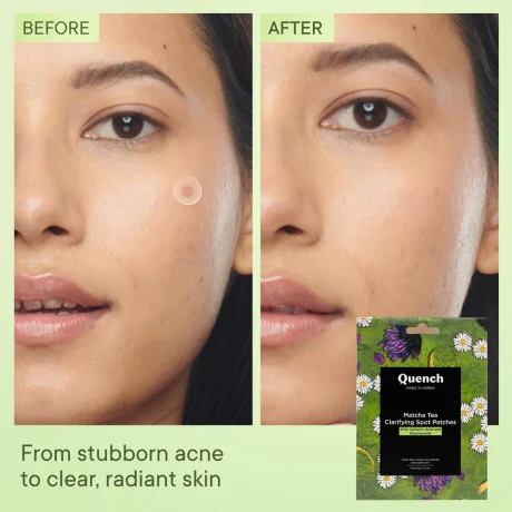 Quench Matcha Green Tea Clarifying Spot Patch pic 4